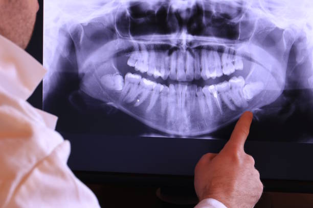 Best Broken or Chipped Tooth Repair in North Granby, CT